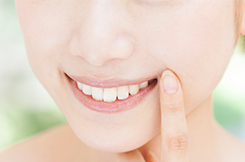 博多区比恵町・
                        スノーデンタルオフィス・ケミカルガムピーリング