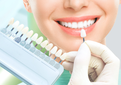 患者さんにも安心のホワイトニングシステム