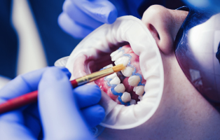 博多区比恵町・スノーデンタルオフィス・カウンセリング